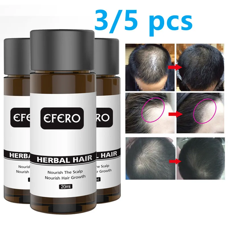 

3/5pcs EFERO Ginger Hair Loss Serum Hair Treatment Anti Lost Beauty Products Fast Grow Repair Scalp Frizzy Damaged Hair Care