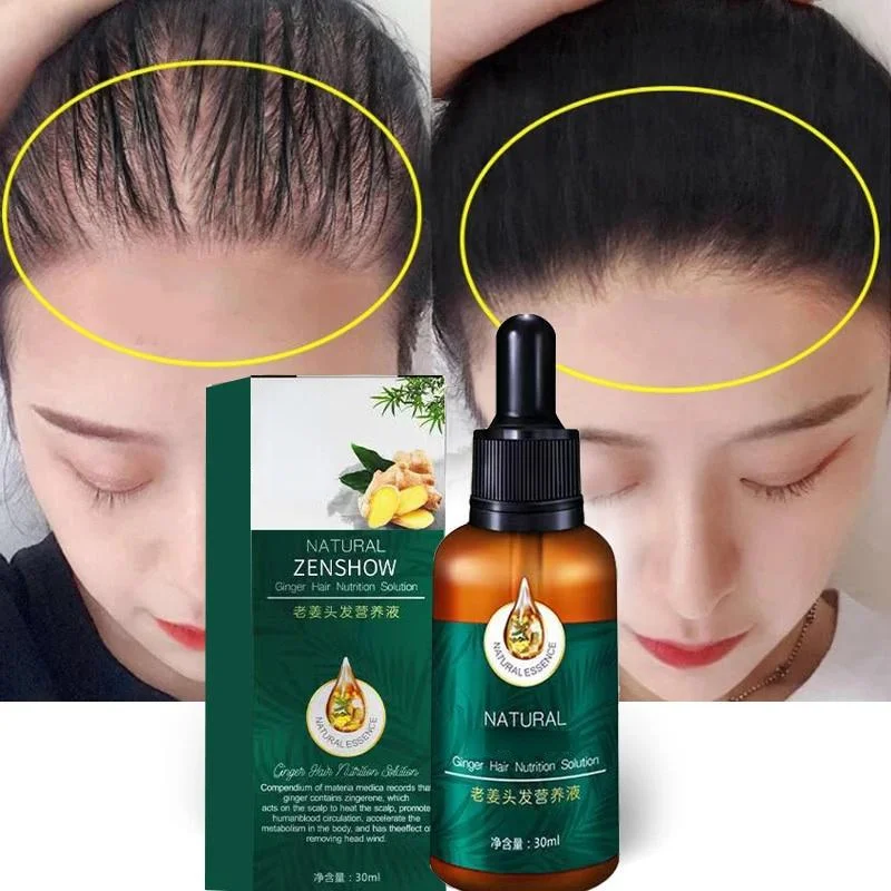 

Hairloss Hair Essential Oil Essence Original Genuine 100% Hair Loss Liquid Health and Beauty Thick Hair Growth Essence