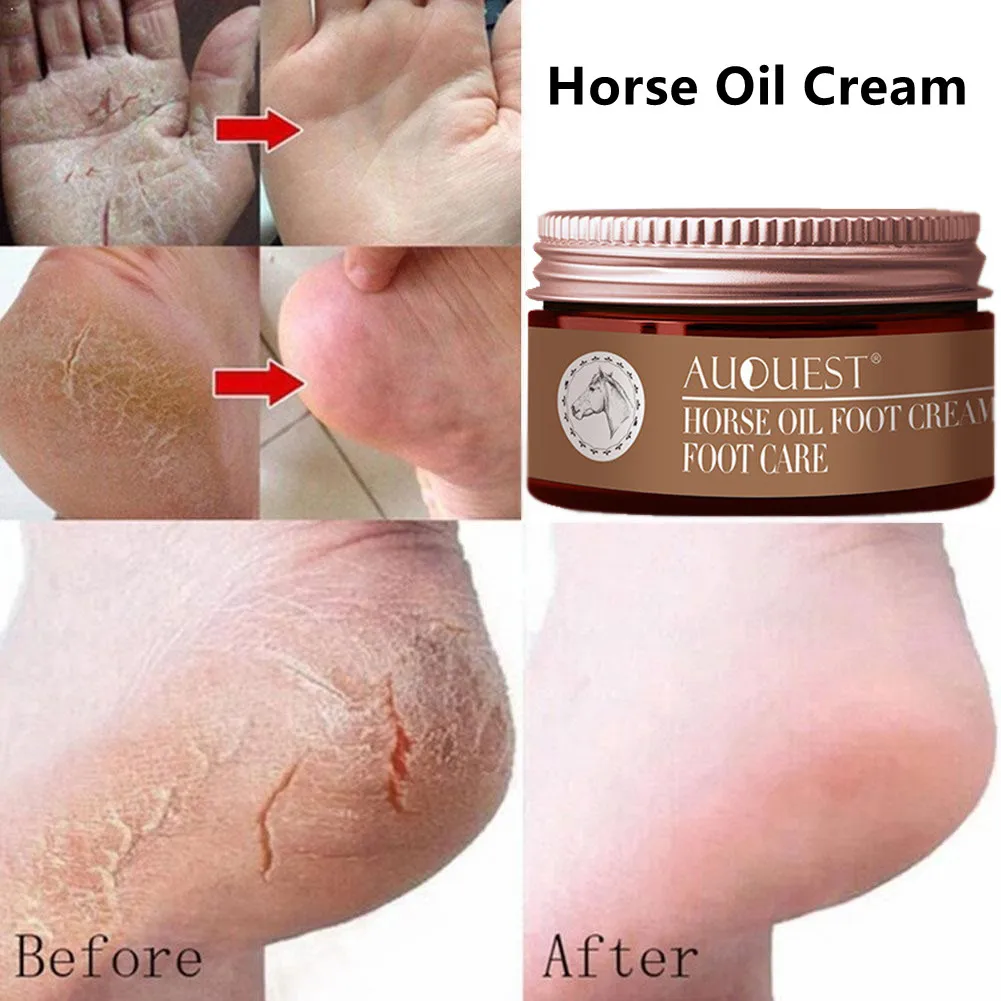 AuQuest 30g Horse Oil Foot Cream Stop Itching AntiFungal Repair Damaged Cortex Cleft Foot Dry Skin Exfoliation Foot Care Product