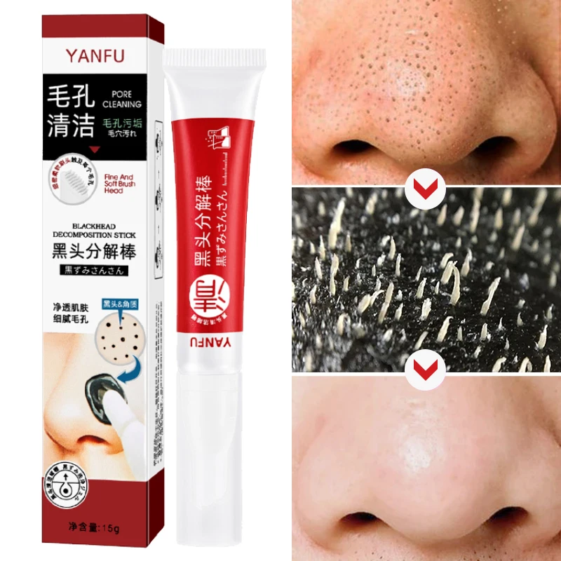 

Deep Cleaning Blackhead Remover Mask Remove Black Improve Acne Shrinking Pore Acne Oil Control Moisturizing Smooth Skin Care