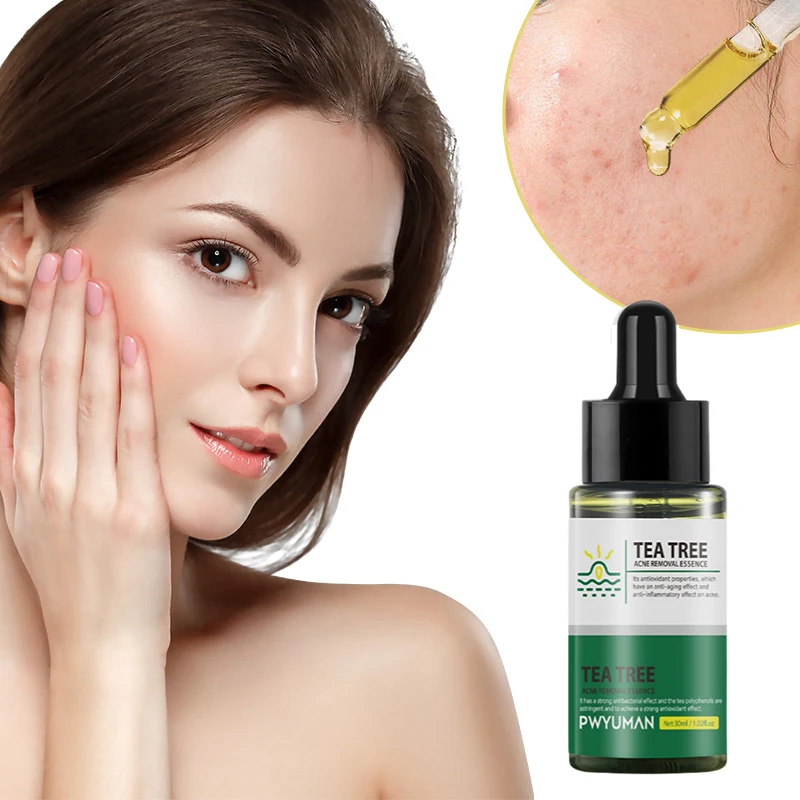 Увлажняющий крем для удаления акне на лице 30 мл