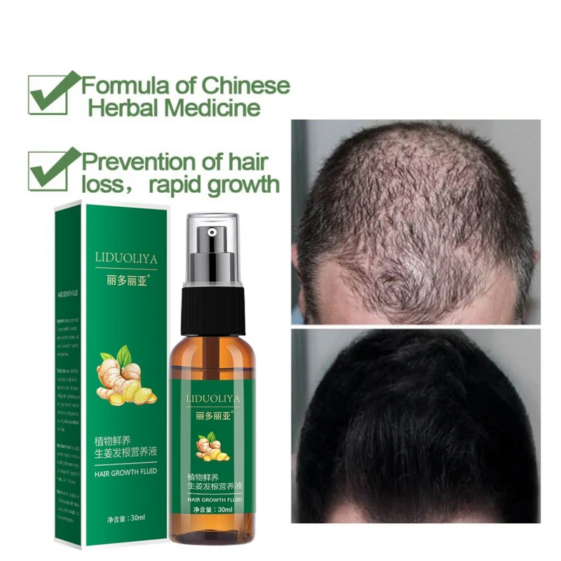 

Ginger Hair Growth Solution Nourish Hair Scalp Anti-fork Hair Regrowth Treatment Product 30ml Anti-Hair Loss Essence Oil