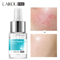 12ml cutin repair serum for sensitive allergic skin care soothe face essence repairing damaged cutin moisturizing shrink pores