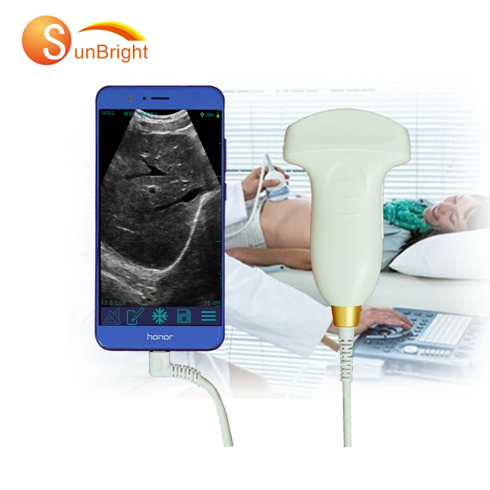 

Промоакция для телефона/компьютера Android, беспроводной USB-зонд, ультразвук