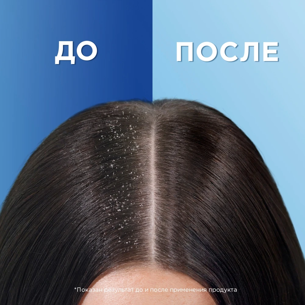 Шампунь против перхоти Head & Shoulders Глубокое Увлажнение для сухих волос и кожи