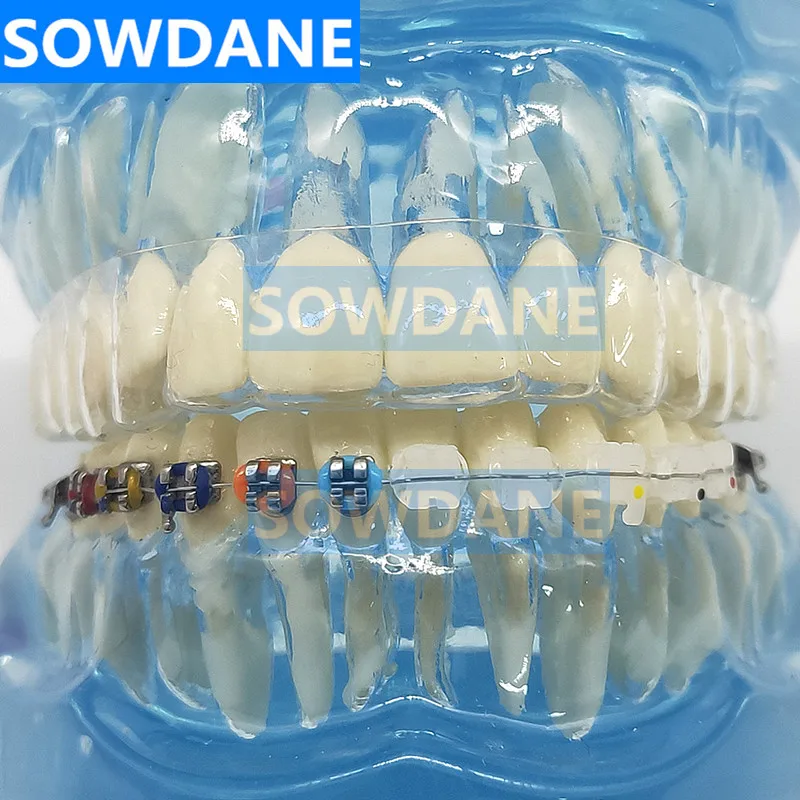 Новая Стоматологическая Ортодонтическая модель зубов для общения с пациентом