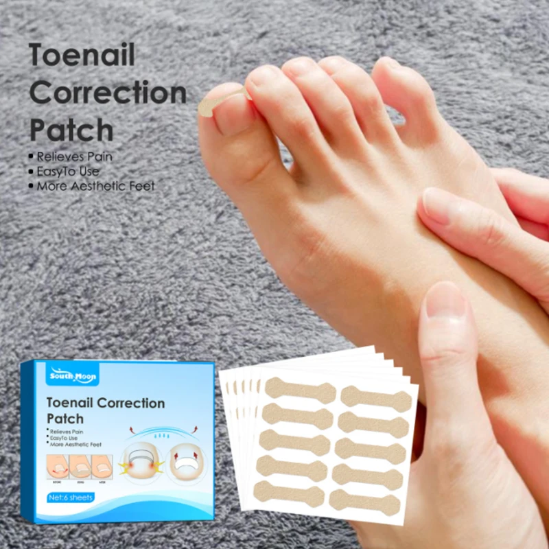 

60 шт., наклейки для коррекции вросших ногтей