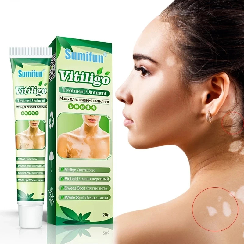 

20g Sumifun New Vitiligo Treatment Ointment Leukoplakia Disease White Spot Skin Repair Cream Pigment Melanin Medical Plaster