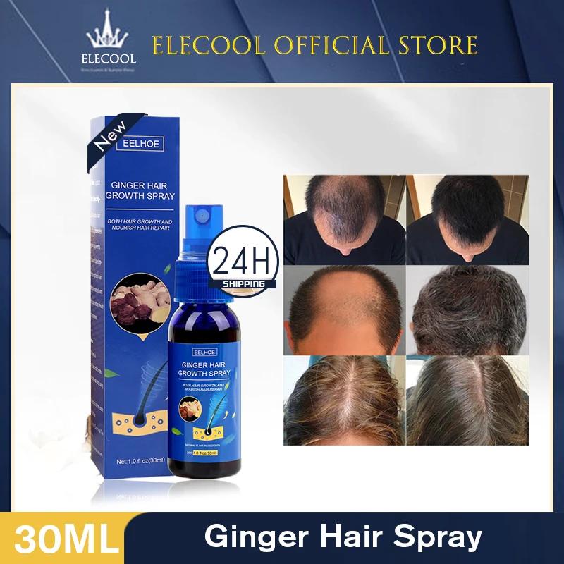 

30ml Ginger Hair Growth Products Fast Growing Spray Scalp Treatments Oil Beauty Health Hair Care Essential Oil Men Women