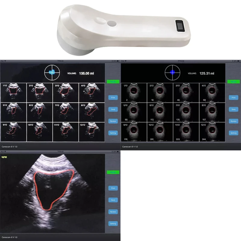 4D Bladder Scanner беспроводной ультразвуковой датчик портативный сканер работает с
