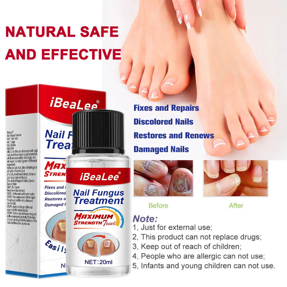 iBeaLee Nail Fungus Treatment 7DAYS Repair Essence Serum Hand Care Nails Foot Fungal Removal Cream Anti-infective Onychomycosis