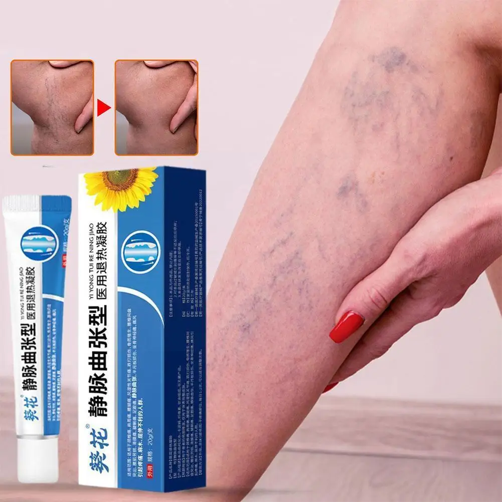 

Холодный компрессионный гель для лечения боли в сосудах ног и отеках, эффективный Пластырь от варикозного расширения вен, дождевого червя, медицинский продукт N9N0