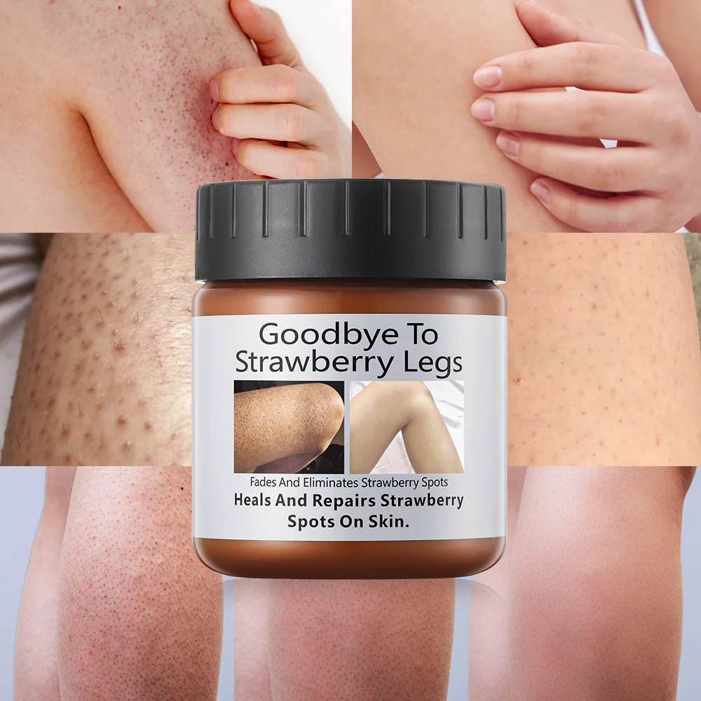 

Goosebump removal exfoliating pimples smooth and rejuvenating skin moisturizing lotion, body cream, goosebump removal, leg cream