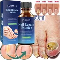 nail repair serum nail fungal treatment serum onychomycosis paronychia anti fungal nail infection toe fungus foot repair care