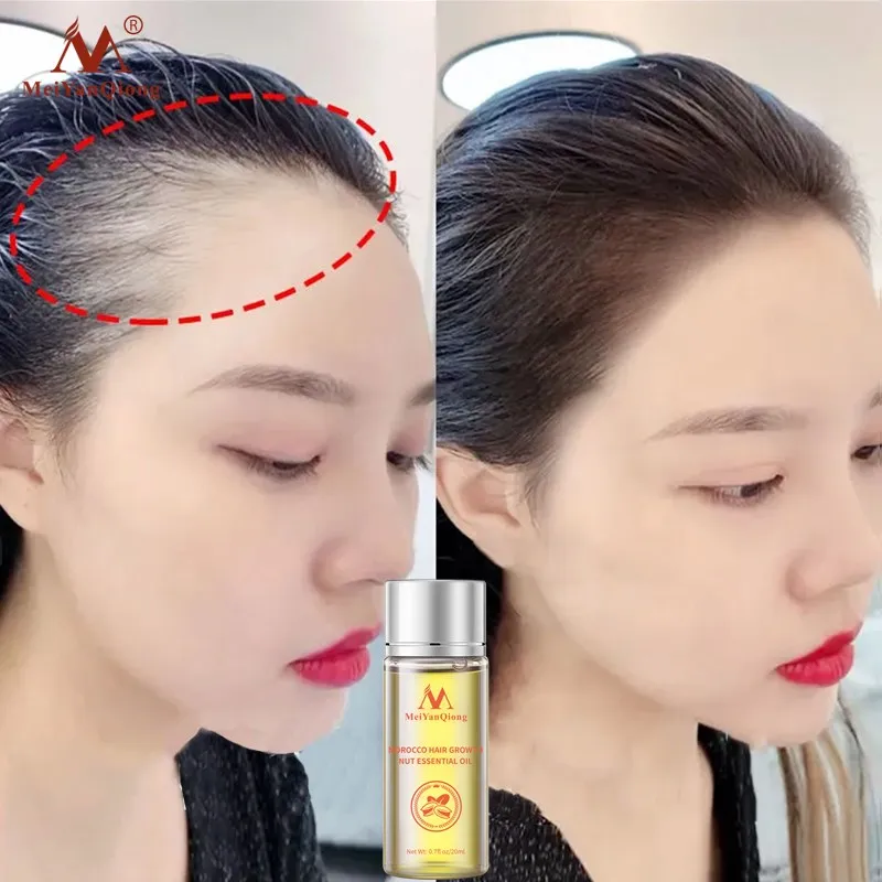 5 шт. марокканских эфирных масел для ухода за сухими волосами питают поврежденные