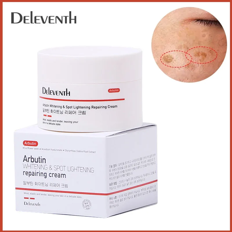 

Fast Freckle Removal Whitening Cream Remove Dark Spots Melanin Melasma Remover Brighten Anti-Aging Lightening Whiten Skin Care