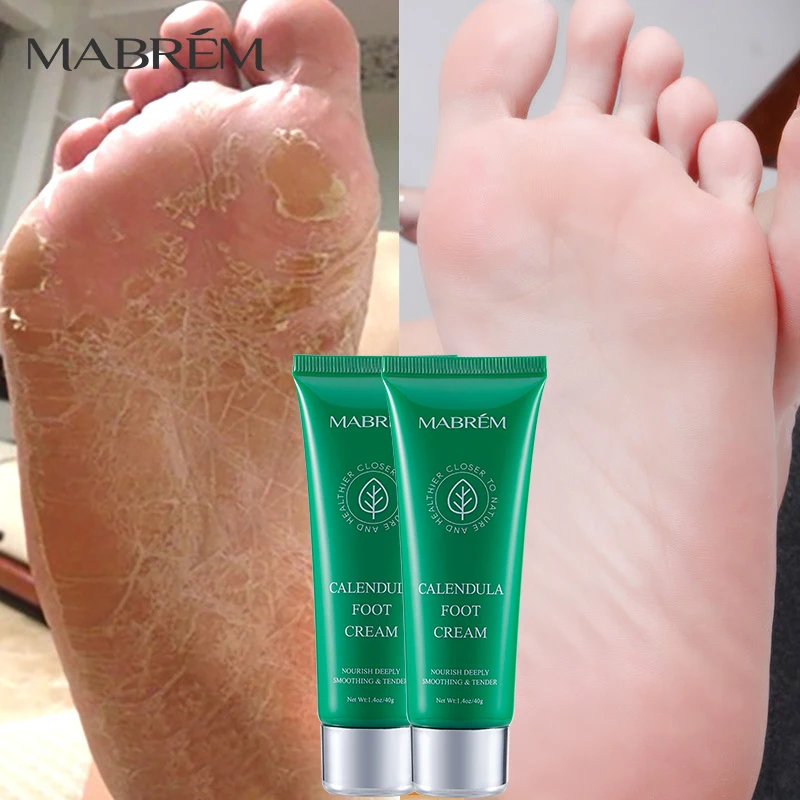 

2PCS Calendula Foot Cream Moisturizing Whitening Skin Rejuvenation Detoxification Wellness Gentle Exfoliating Cream Deodorant