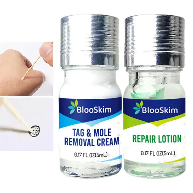 

Wart Removal Liquid Liquid Wart Removal Mild Mole Removal Face Mole Remover For All Skin Types Body Neck