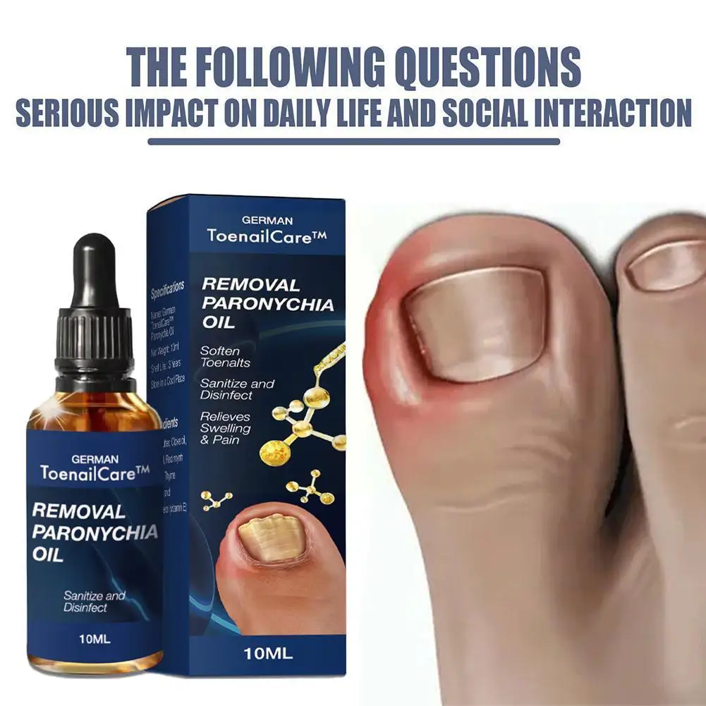 

Средство для удаления вросших ногтей, 10 мл