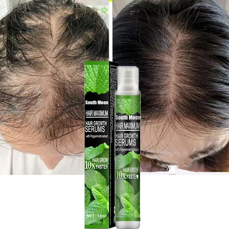 

Hair Growth Spray Mint Essence Anti Hair Loss Products Dry Frizzy Scalp Treatment Prevent Baldness Fast Grow Nourish Men Women