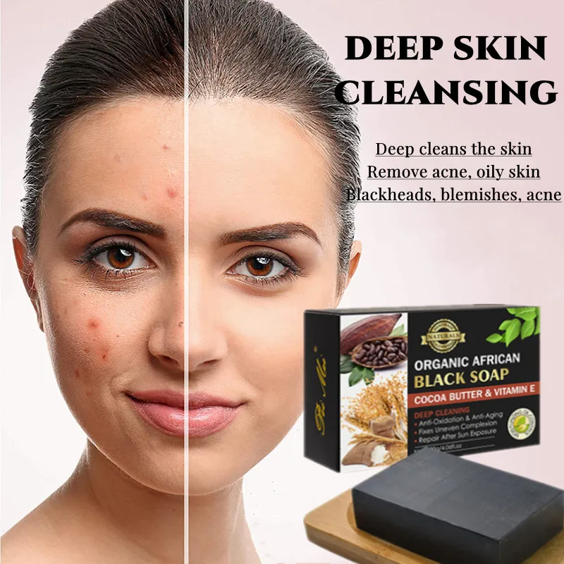 

Black Soap Cocoa Bean Vitamin E Black Soap Body Moisturizing Cleansing Skin Soap Whitening Soap Body and Face Whitening