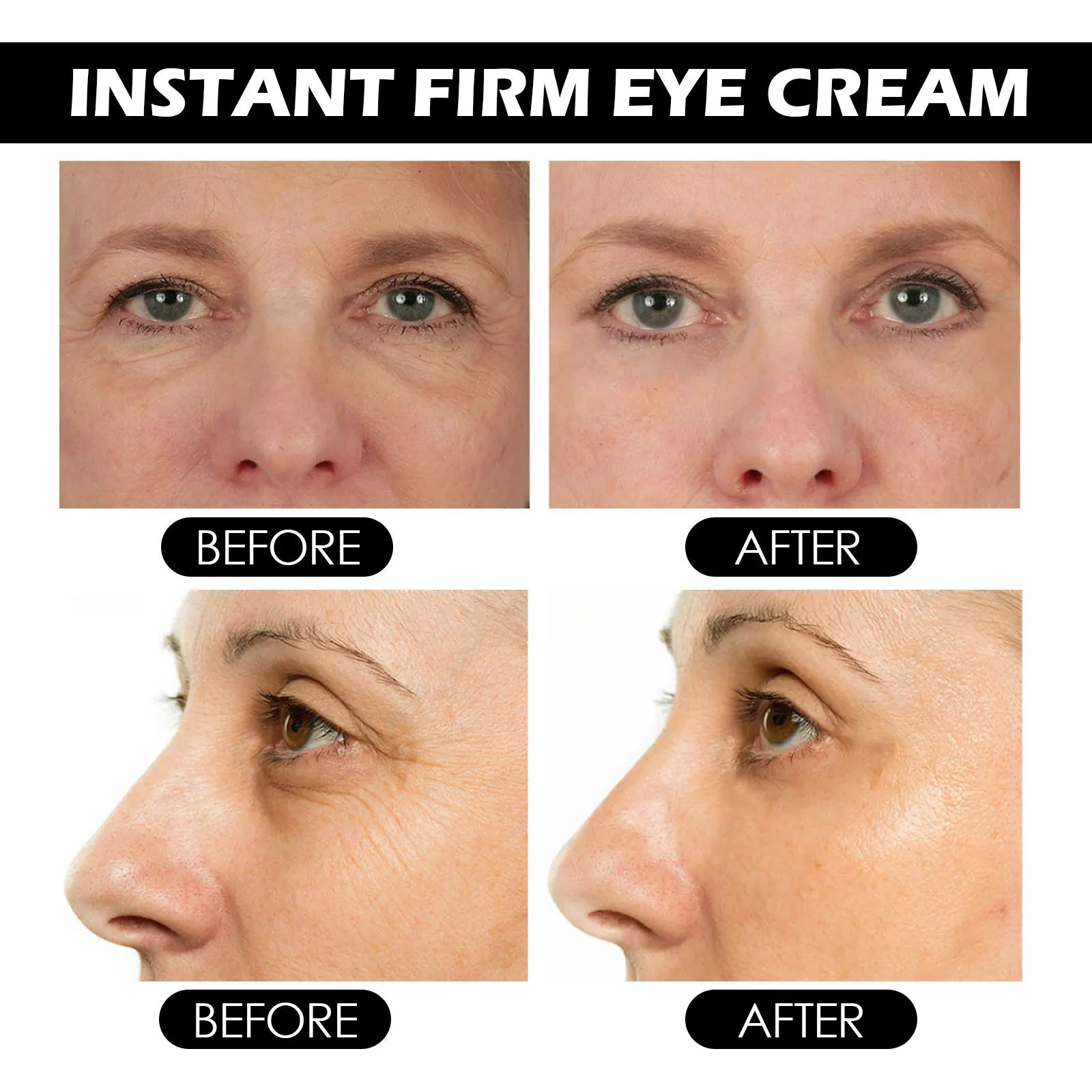 4 шт. крем для кожи вокруг глаз от Тёмных кругов и тёмных