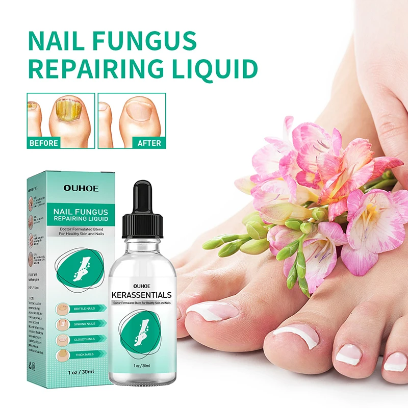

Nail Fungal Treatment Serum Onychomycosis Paronychia Anti Infection Toe Fungus Hand Foot Removal Repair Gel Care Beauty Health