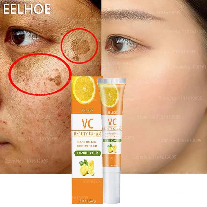 

Effective Whitening Face Cream Vitamin C Fade Freckls Dark Spots Pigmentation Melanin Facial Gel Moisturizing Firming Skin Care