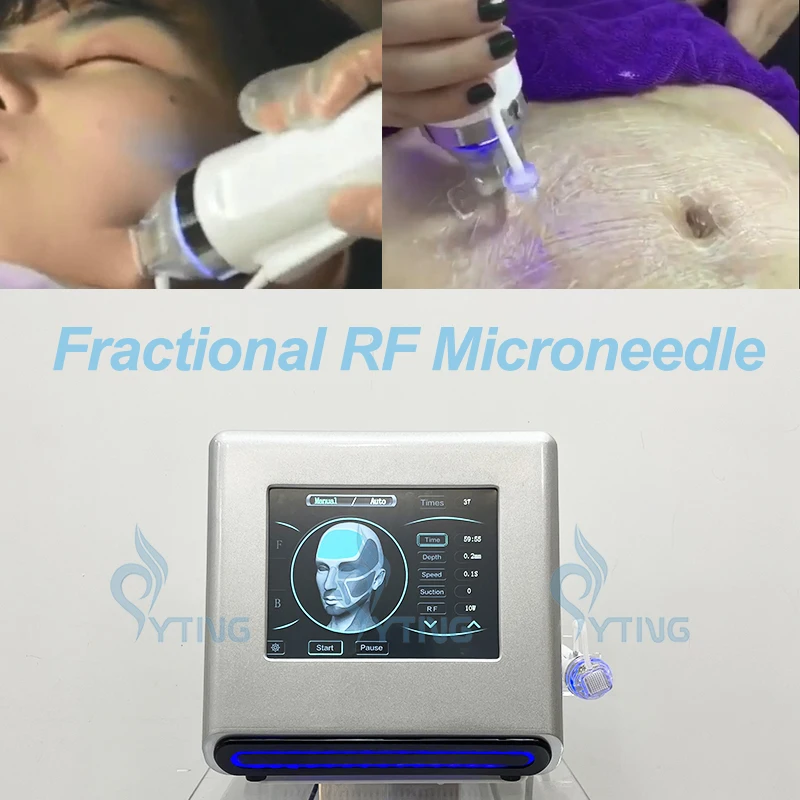 

RF Fractional Microneedle Machine with 4 Pcs for Stretch Mark Removal ,Acne Treatment and Lifting -Wrinkle