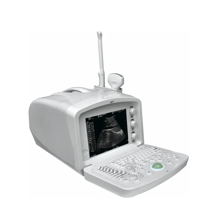 

BT-UD007 medical portable black and white Digital Portable Ultrasonic Diagnosis system to Human ultrasound machine price