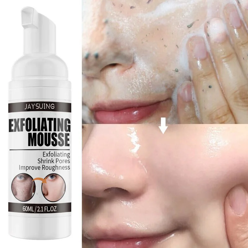 Facial Exfoliating Mousse Deep Remove Cleaning Blackhead Dead Skin Shrink Pores Whitening Moisturizing Oil Control Face Cleaner