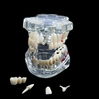 new arrivel dental consumable teeth model medical studying implant disease with restoration bridge tooth dental teaching model