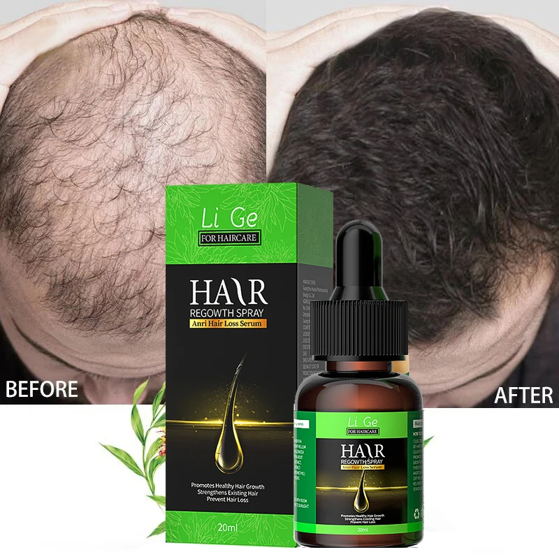 Восстановление выпадения волос. Ibealee hair. Масло для роста волос для собаки. Эфирное масло для роста волос bleyree. Эфирное масло которые уничтожат луковицу против роста волос.