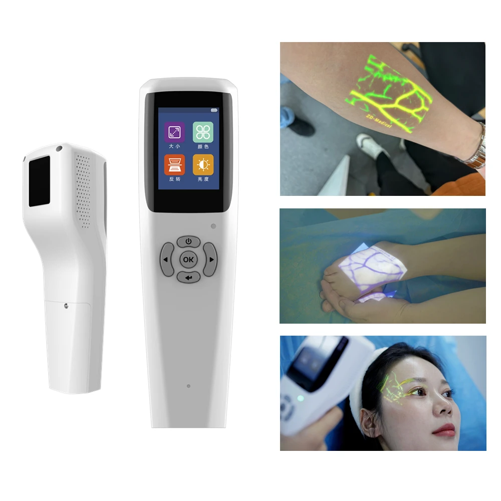 Медицинский проекционный ручной прибор для обнаружения венозных сосудистых