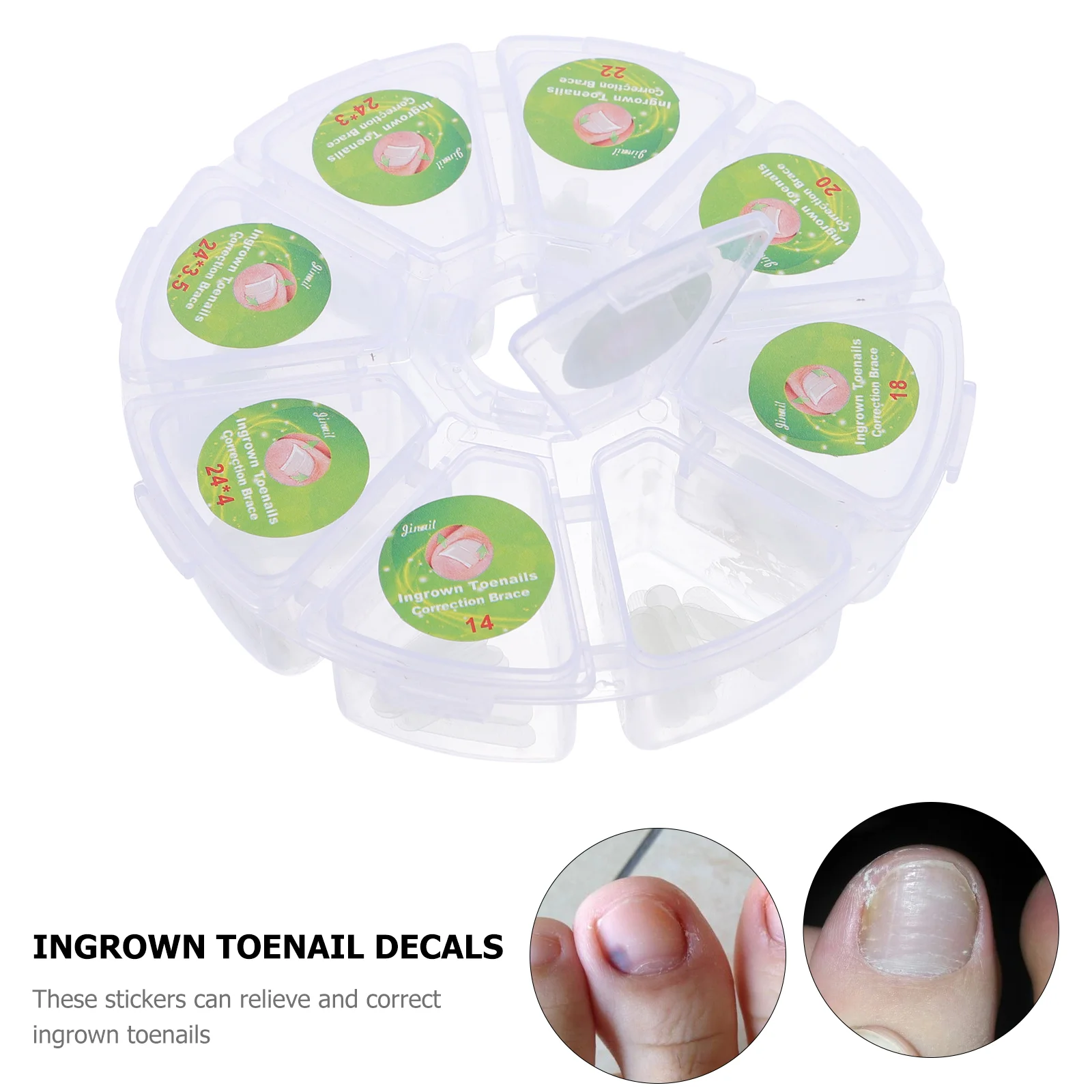 100 шт. пластырь для коррекции вросших ногтей наклейка личной гигиены полоски на