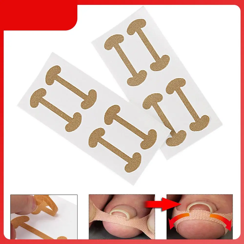 

4 Stickers/sheet Ingrown Toenail Correction Tool Toe Nail Elastic Patch Sticker Straightening Clip Brace Pedicure Tool