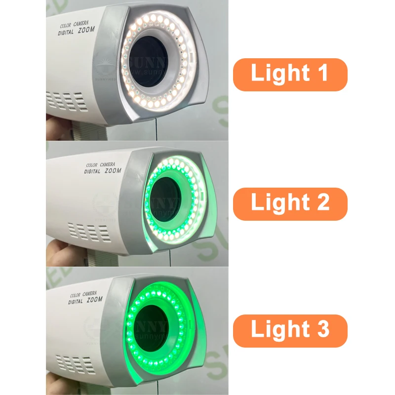 SY-F005-3 Портативный портативный цифровой видеовагинальный кольпоскоп Full HD