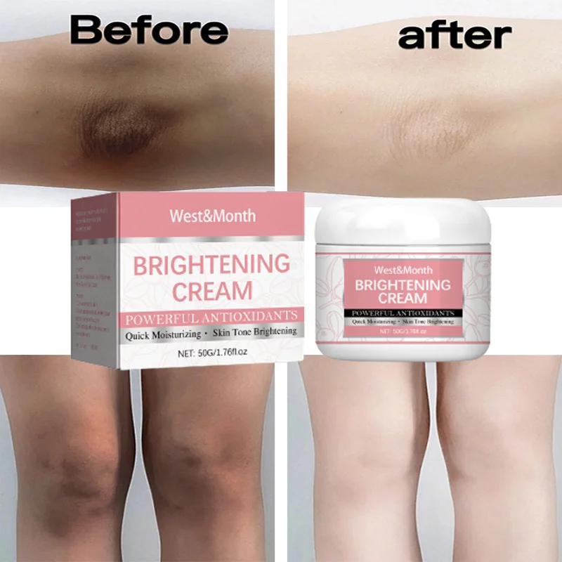 

Body Whitening Cream For Dark Skin Elbow Joint Underarm Knee Private Parts Melanin Brighten Bleaching Lotion Care Moisturizing