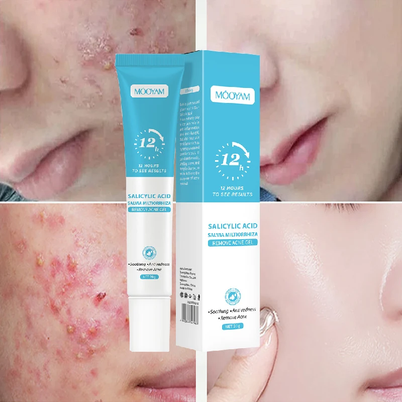 

Salicylic Acid Acne Cream Fade Pimples Marks Anti-Pimple Clogging Essence Shrink Pores Remove Blackheads Oil Control Skin Care