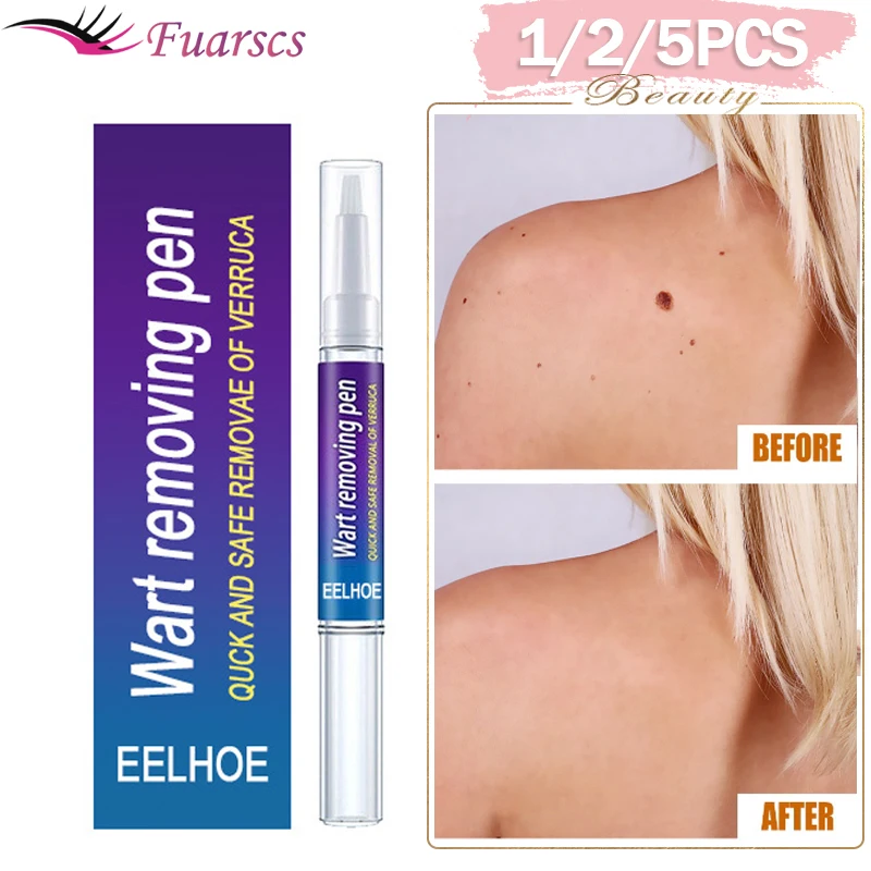 

1/5PCS Removing Against Moles Liquid Pen Treatment Papillomas Removal Of Warts Liquid From Skin Tags Remover Anti Verruca Remedy