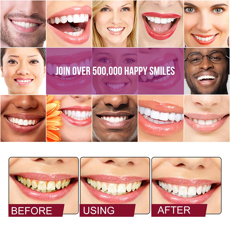 SP-4 пробиотики кариес зубная паста отбеливающая восстанавливающая для