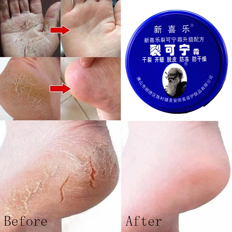 

33g Anti Crack Foot Cream Dryness Foot Mask Heel Cracked Repair Cream Hand Mositurizing Removal Callus Dead Skin Hands Feet Care