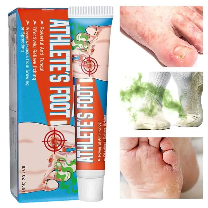 

20g Anti Beriberi Foot Cream Anti Feet Repair Cream Athlete's Foot Toe Nail Cream