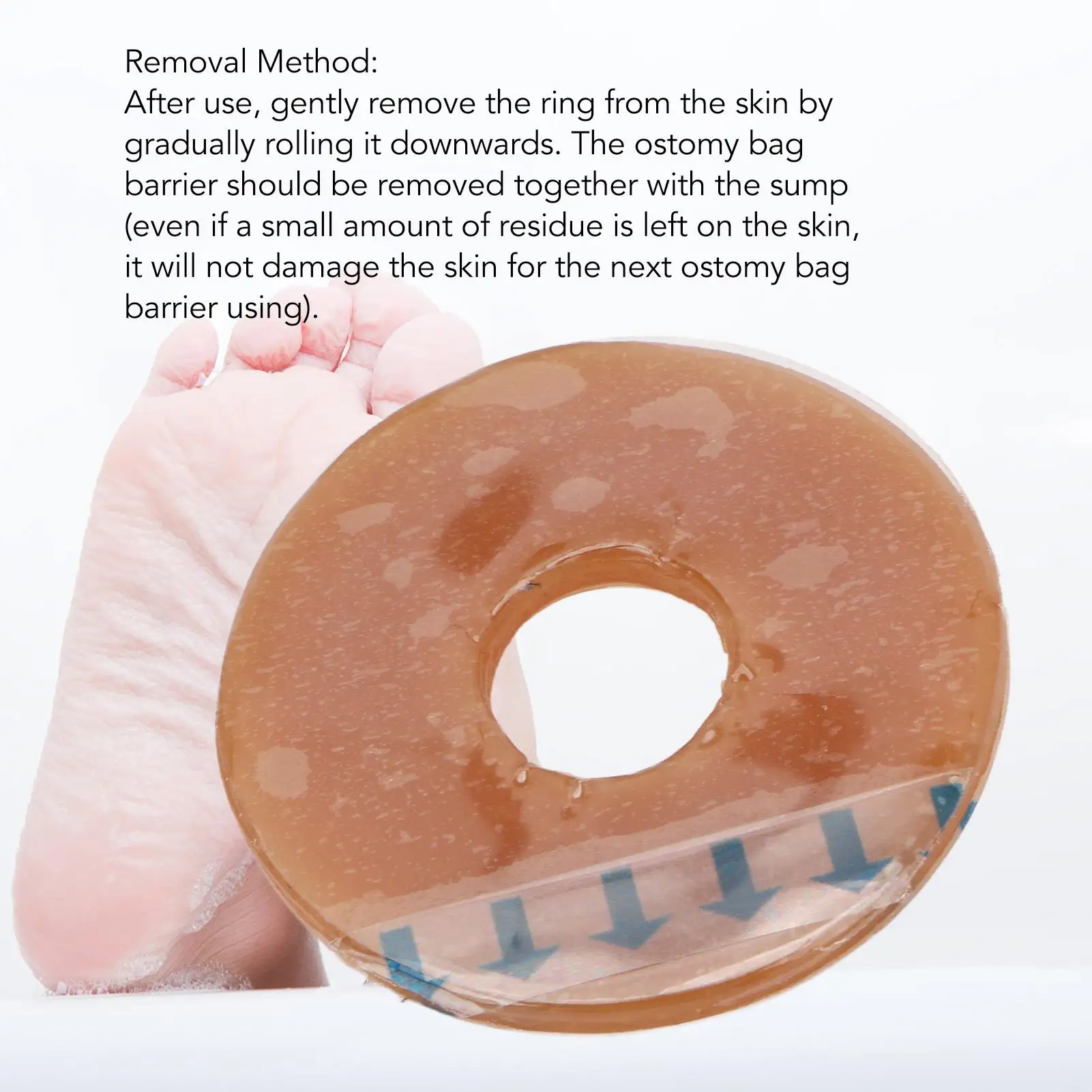 Силиконовый цветной мешок барьер для кожи остомии пациентов-для ухода за