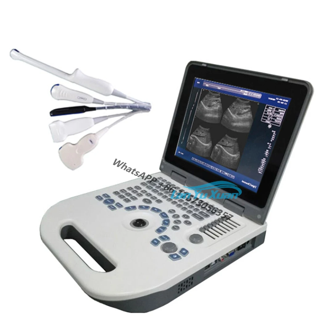 

HBW-3P Good Price Hospital Diagnostic Equipment Laptop Escaner Ultrasonido Medical Portable B Ultrasound Machine