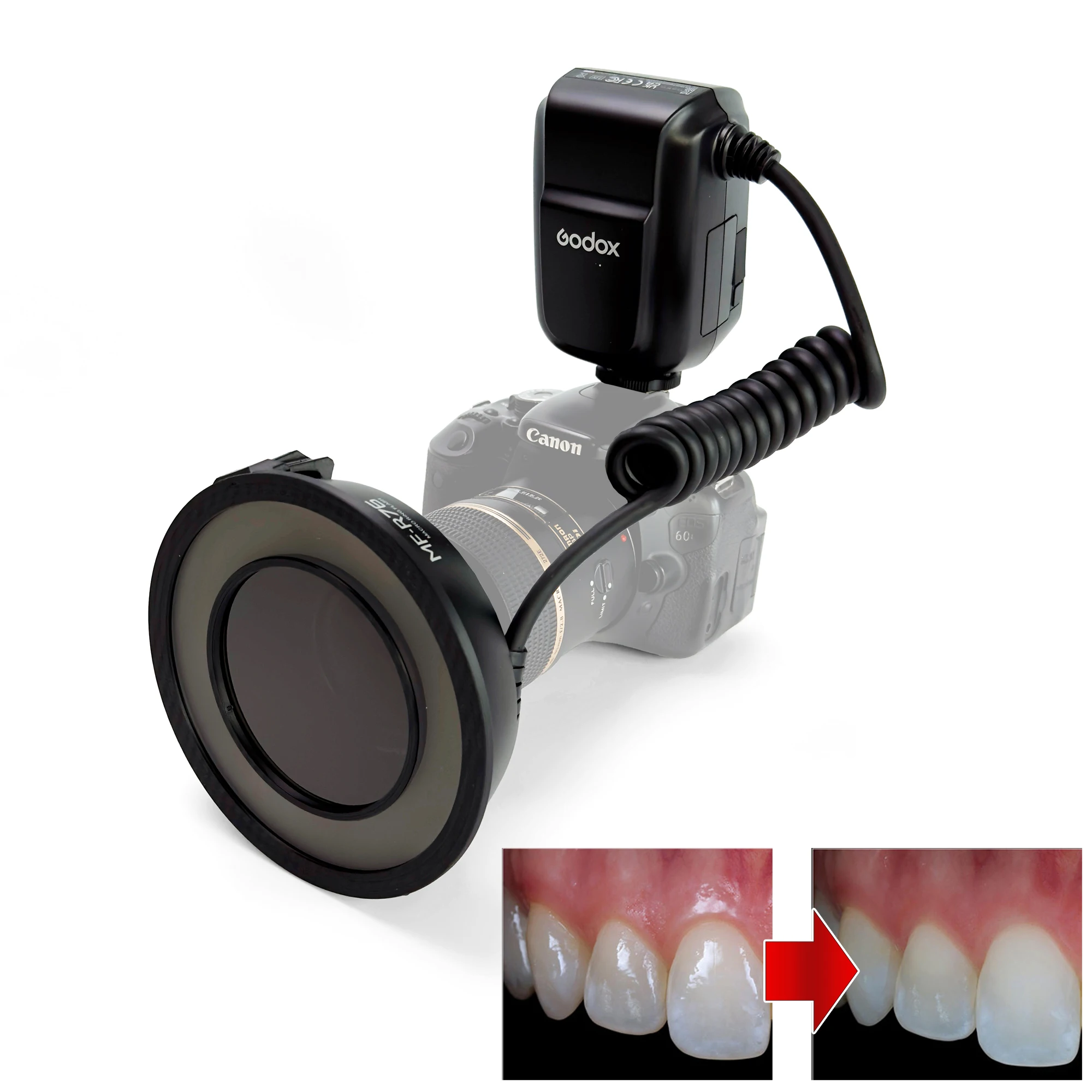 Комплект поляризованного стоматологического диагонального освещения со