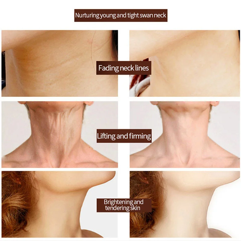 Рисунок 2 - Ретинол против морщин крем для