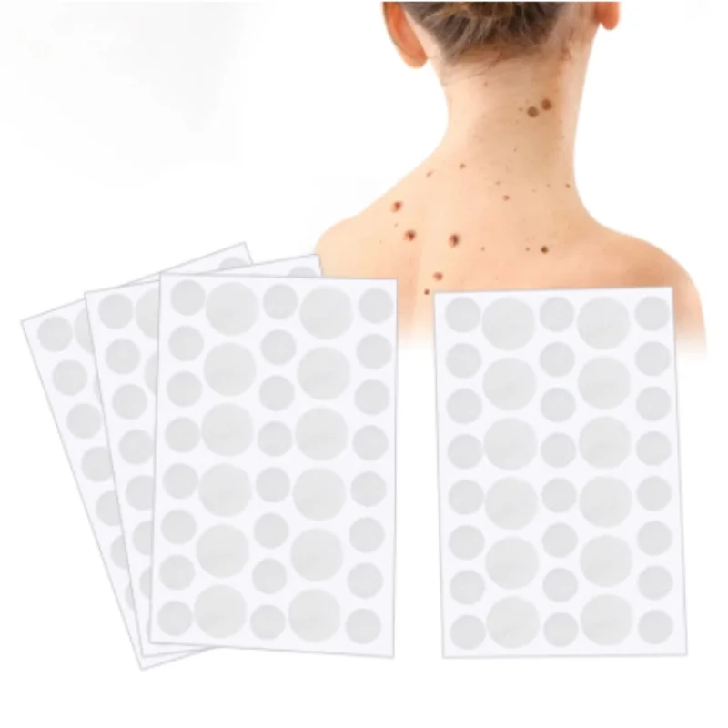 36Pcs Warts Remover Patch Skin Tags Treatment Cream Herbal Extract Foot Corn Plaster Acne Stickers 2021 | Красота и здоровье