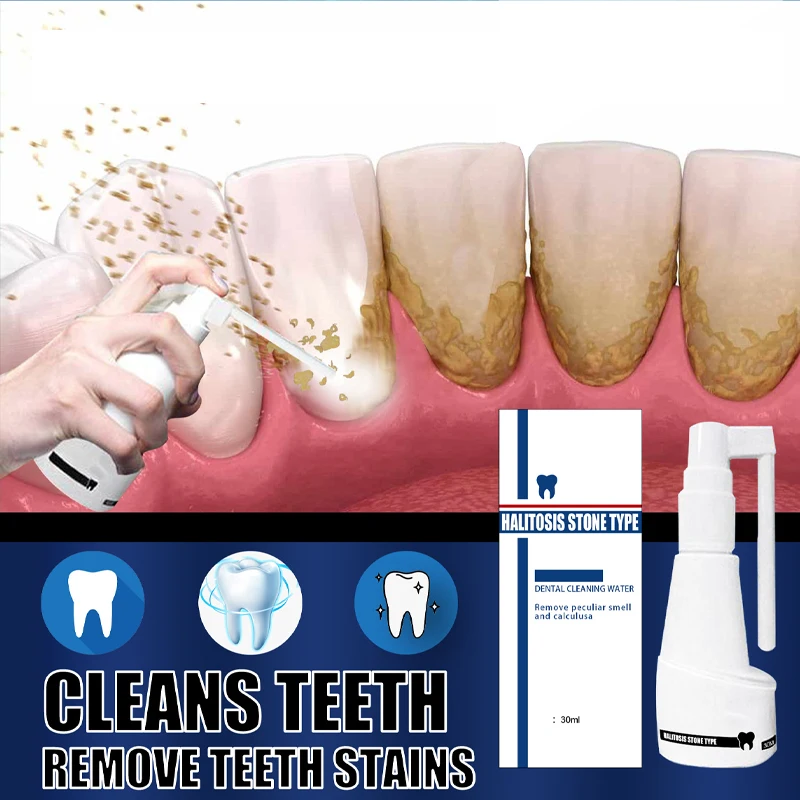 

New Arrival 30g Dental Calculus Dissolving Spray Bacteria Deodorizing Dental Calculus Lasting and Refreshing Whitening Care Tool