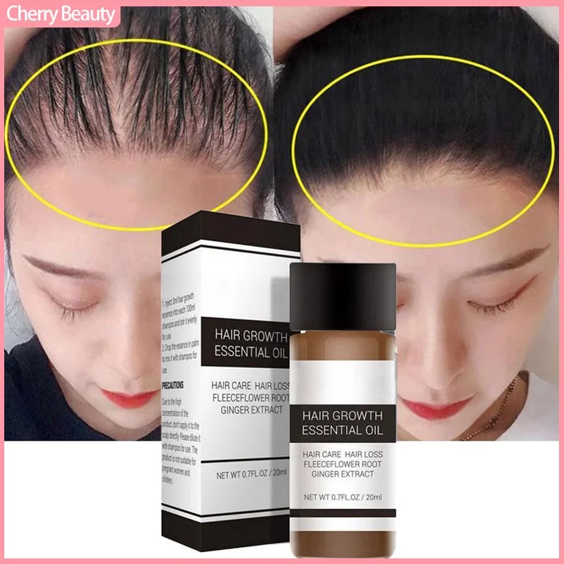 

Hair growth oil shampoo fast powerful essential oil treatment liquid 20g